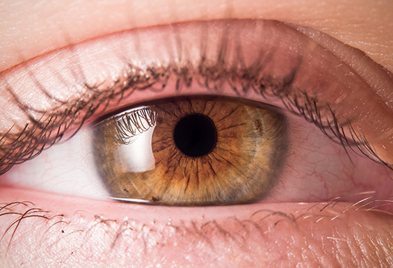 Close Up Eye After Vitrectomy