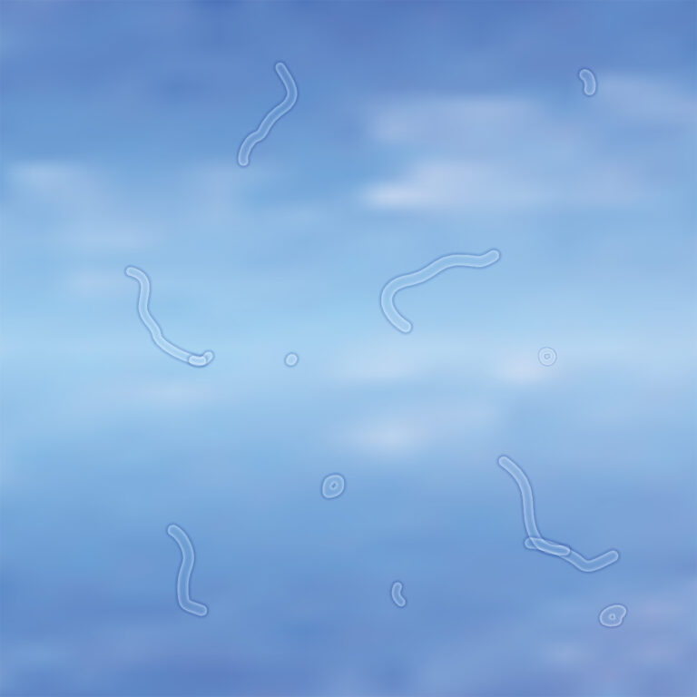 Seeing Flashes or Floaters? Get an Exam | Retina Associates of Kentucky