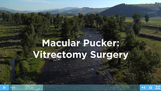 Macular Pucker Video