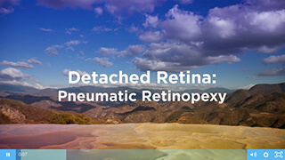 Detached Retina Video